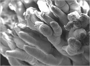 Mycotoxins and their effects on gastro-intestinal tract